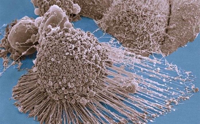 Dividing Cancer Cells