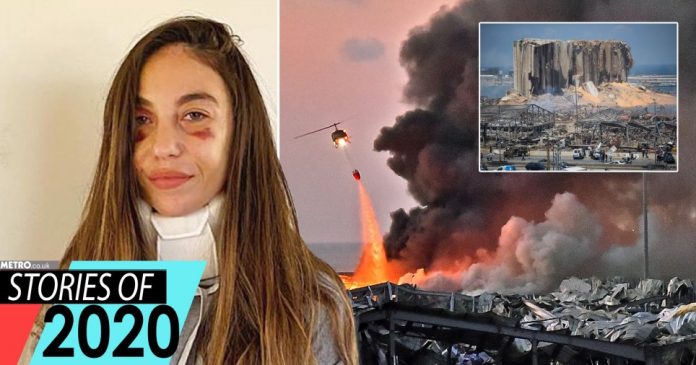 Clara, who was injured in the Beirut blast