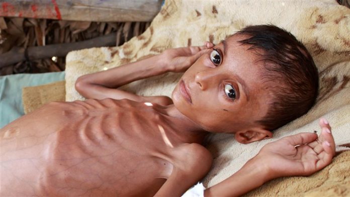 Trump admin debates labelling Yemen's Houthis terrorists — aid groups warn thousands face famine