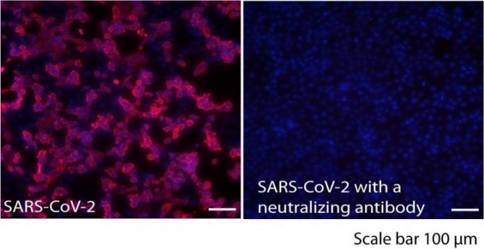 SARS-CoV-2 Infected Vero Cells