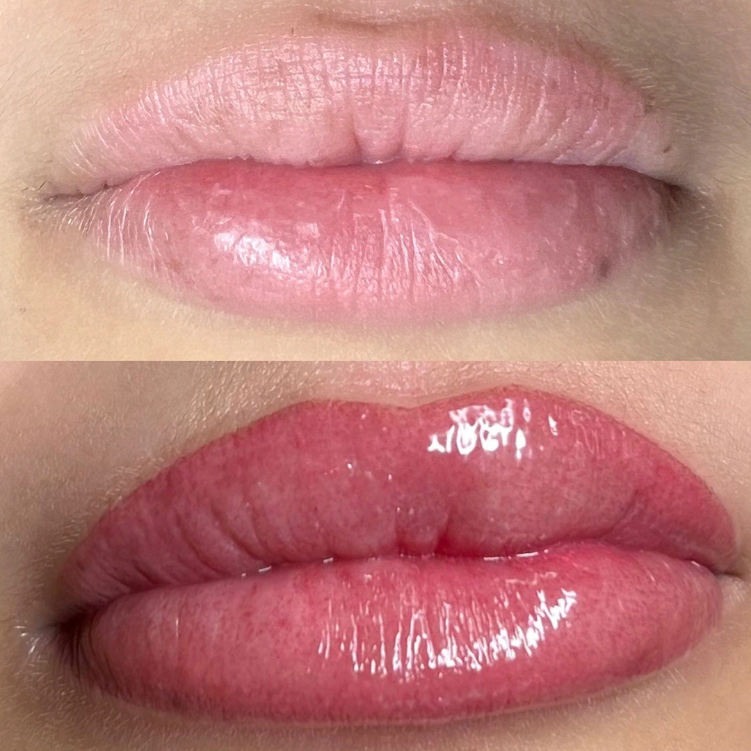 Everything You Need to Know About Lip Blushing