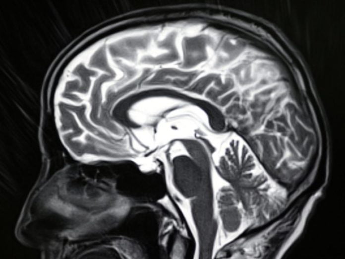 Human Brain MRI Image