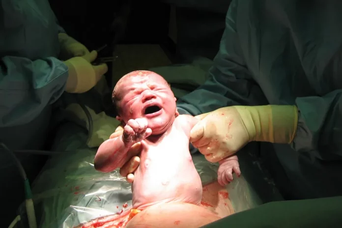 Baby Caesarean Birth
