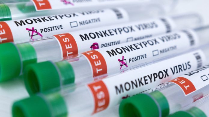The CDC is sending monkeypox vaccines to people at high risk in a race to prevent the spread